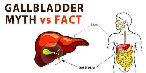 Gallbladder Surgery A Brief Review Of Cholecystectomy
