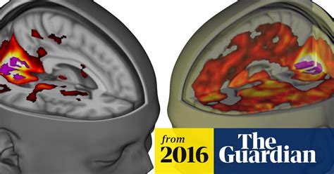 lsd s impact on the brain revealed in groundbreaking images science the guardian
