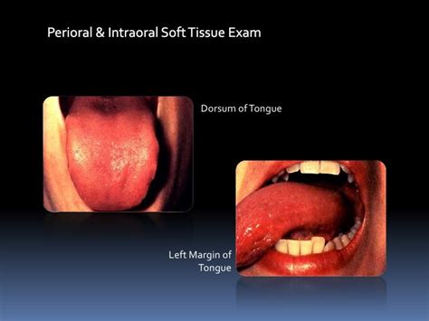 15 Oral Soft Tissue Lesions And Minor Oral Surgery