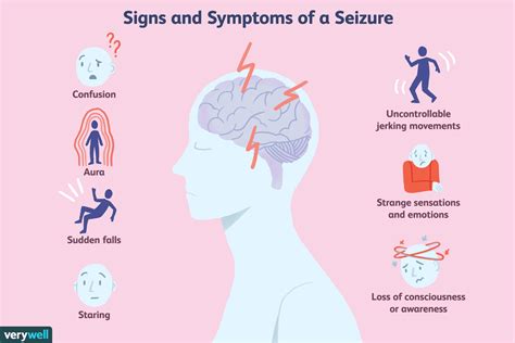 Seizures Symptoms Causes Treatment Santripty
