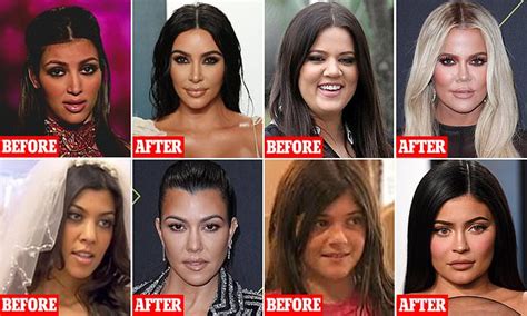 Kourtney Kardashian Nose Job Before And After