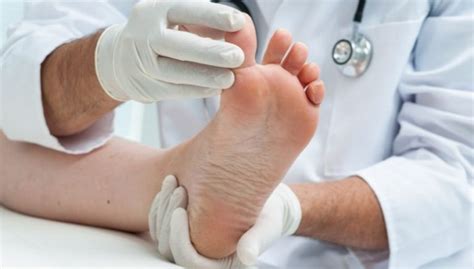 Grierson Gopalan Syndrome Burning Feet Syndrome