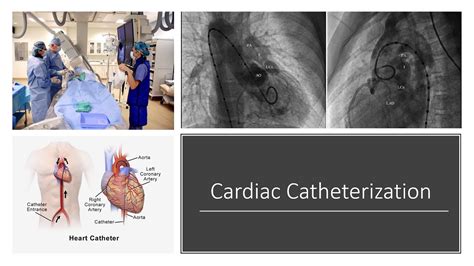 Cardiac Catheterization Youtube