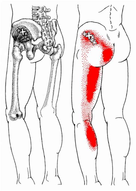Learn the iliopsoas, gluteal and hip adductors with diagrams now at kenhub. Pin on Psoas Release