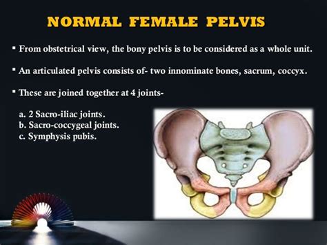 Contracted Pelvis