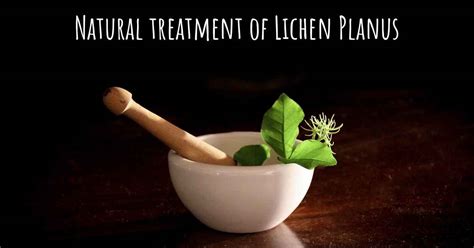 Is There Any Natural Treatment For Lichen Planus