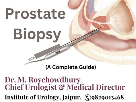 Radiotherapy For Prostate Cancer Institute Of Urology