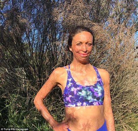 Turia Pitt Talks About Her Pregnancy With Women S Weekly Daily Mail Online