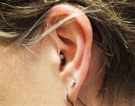 Pin On Hearing Loss Ears Ringing