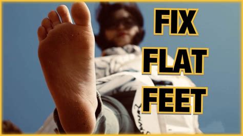 How To Fix Flat Feet Without Surgery At Home Exercises Youtube