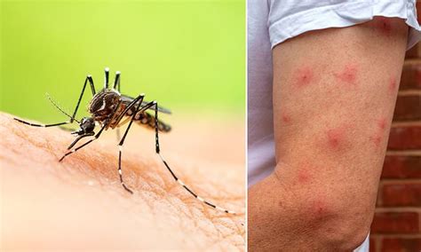 Urgent Warning For Australians After A Huge Spike In Mosquito Borne