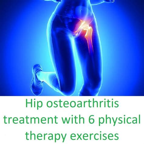 Hip Osteoarthritis Treatment With 6 Physical Therapy Exercises