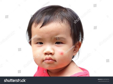 Asian Baby Big Red Spot Mosquito Stock Photo 268786529 Shutterstock