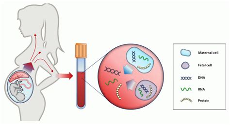 Çfarë Duhet Të Dinë Nënat E Ardhshme Për Diagnozën Prenatale Gjenetike