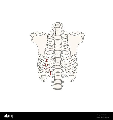 Human Anatomy Drawing Subcostal Muscles Stock Photo Alamy