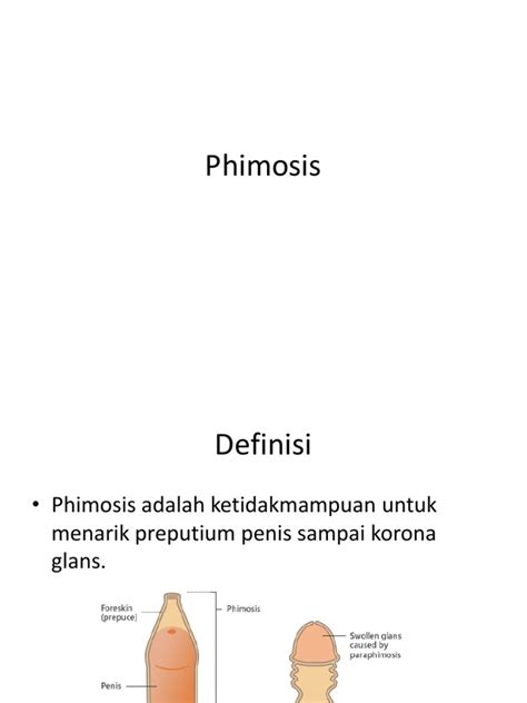 Phimosis Ppt