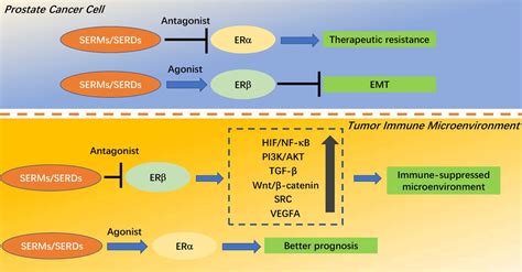 Selective Estrogen Receptor Modulators Contribute To Prostate Cancer