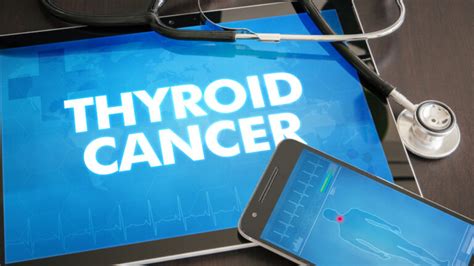 Treatments For Various Types Of Thyroid Cancer