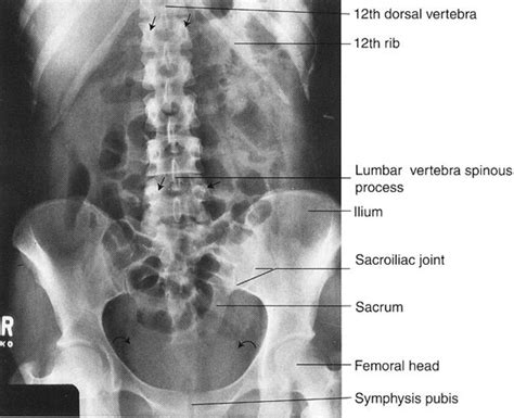 Normal Abdominal Anatomy