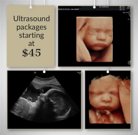 What Is Elective Ultrasound