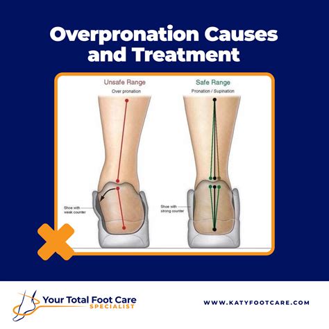 Overpronation Causes And Treatment Your Total Foot Care Specialist