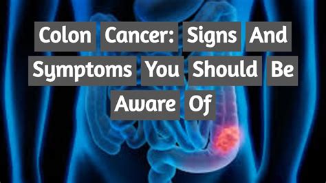 Colon Cancer Signs And Symptoms You Should Be Aware Of Youtube