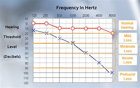 Understanding The Importance Of Your Hearing Test Results Home