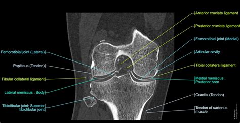 Anatomy Of The Knee Ct Arthrography E Anatomy