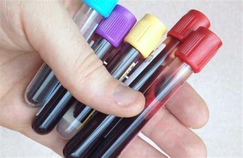 Israeli American Researchers Find Blood Marker That Could Lead To