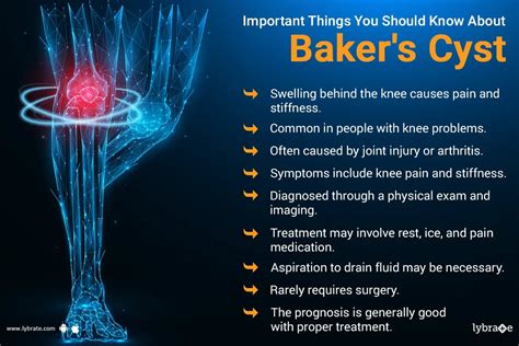 Baker Cysts Symptoms Causes And Treatment Options By Dr Mohit Madan Lybrate