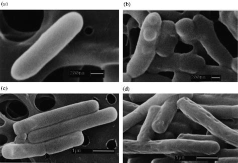 Scanning Electron Micrographs Of B Fragilis Nctc 9343 Top And C