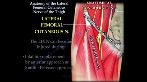 Anatomy Lateral Femoral Cutaneous Nerve Of Thigh SexiezPix Web Porn