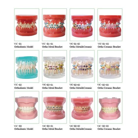 Orthodontic Dental Study Models Tooth Teaching Dental Models For