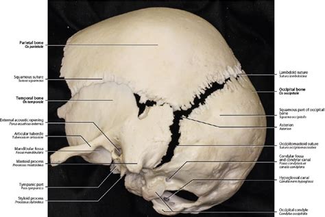 2 Bones Of The Skull And Skull Bone Articulations Neupsy Key