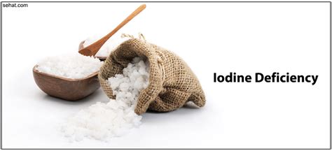 Iodine Deficiency Disorders Sehat