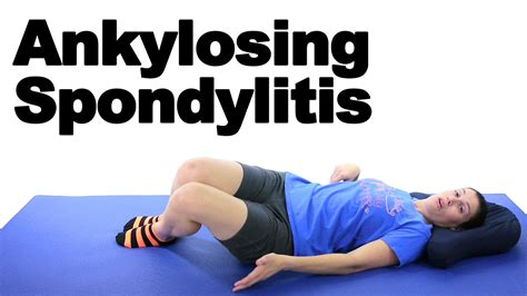 Ankylosing Spondylitis Stretches Exercises Ask Doctor Jo YouTube