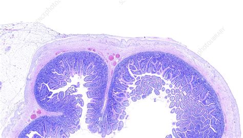 Duodenum Light Micrograph Stock Image C0517266 Science Photo