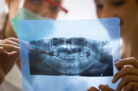 Importance Of X Rays In Orthodontics Carlyle Orthodontics
