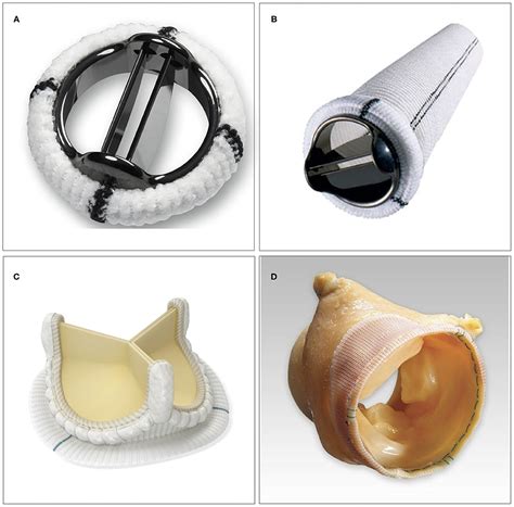 Mechanical Aortic Valve Replacement