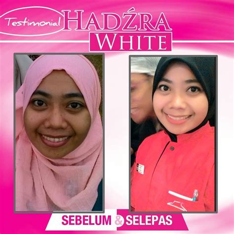 **andaikata produk pandaa ini tidak berkesan langsung (bulu tidak tanggal langsung walaupun sehelai) walaupun telah mengikut cara penggunaan yang disarankan, maka kami tidak. Gedung Cantik 0195149989: REVIEW : HADZRA WHITE PRODUK ...
