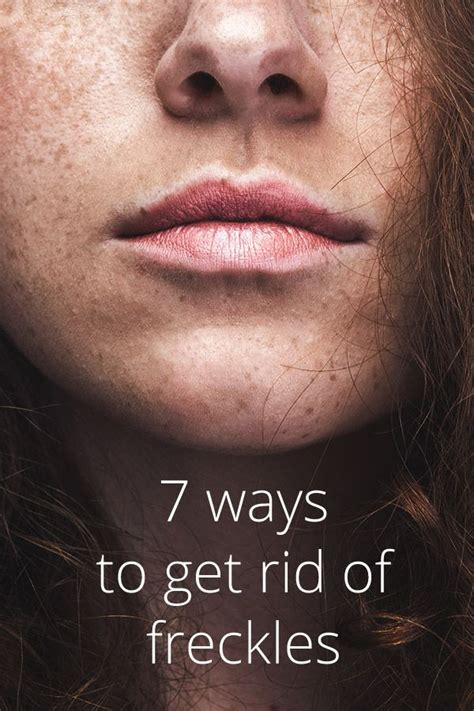 How To Get Rid Of Freckles 7 Ways Getting Rid Of Freckles Freckles