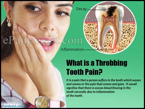 What Causes Throbbing Tooth Pain And How Is It Treated
