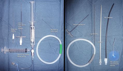 Neurocriticalcare Peritoneal Catheter Insertion Ultrasound Guided