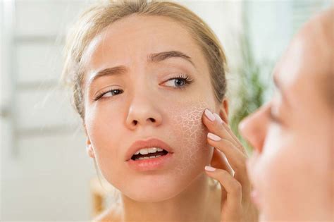 Tips From A Dermatologist To Get Rid Cystic Acne Women And Ncds