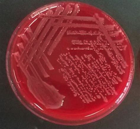 Salmonella On Blood Agar Thermo Scientificblood Agar Tsa With 5 Sheep