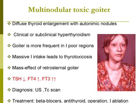 The Diseases Of Thyroid Online Presentation