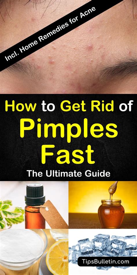 8 Great Home Remedies To Get Rid Of Pimples Fast