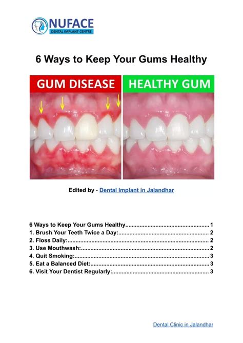 Ppt 6 Ways To Keep Your Gums Healthy Powerpoint Presentation Free