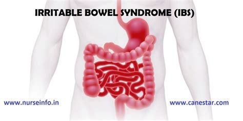 Irritable Bowel Syndrome Ibs Nurse Info