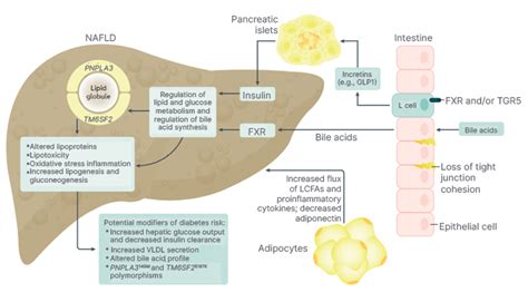 Non Alcoholic Steatohepatitis Global Impact And Clinical Consequences